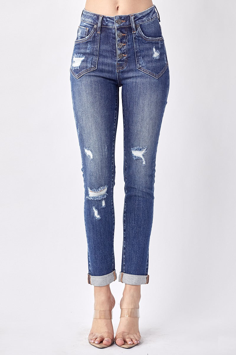 Plus Risen Buttonfly Skinny Jeans